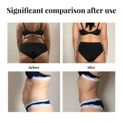 EELHOE Slimming Patch, Lazy Slimming Body Sculpting Body Belly Button Tight Belly Button Pill Belly Belly Thighs