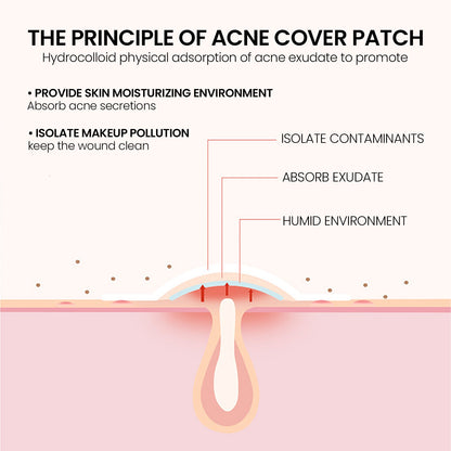 Pimple Patches,Pimple Patches For Face, Hydrocolloid Acne Patches, Cute Star Stickers Hydrocolloid Acne Pimple Patch For Covering Zits And Blemishes